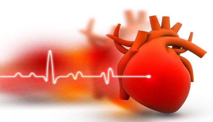 arterijska hipertenzija